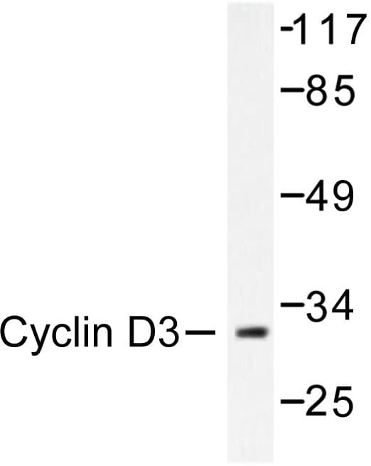 Polyclonal Rabbit anti-Human CCND3 / Cyclin D3 Antibody (Gly277, IHC, WB)