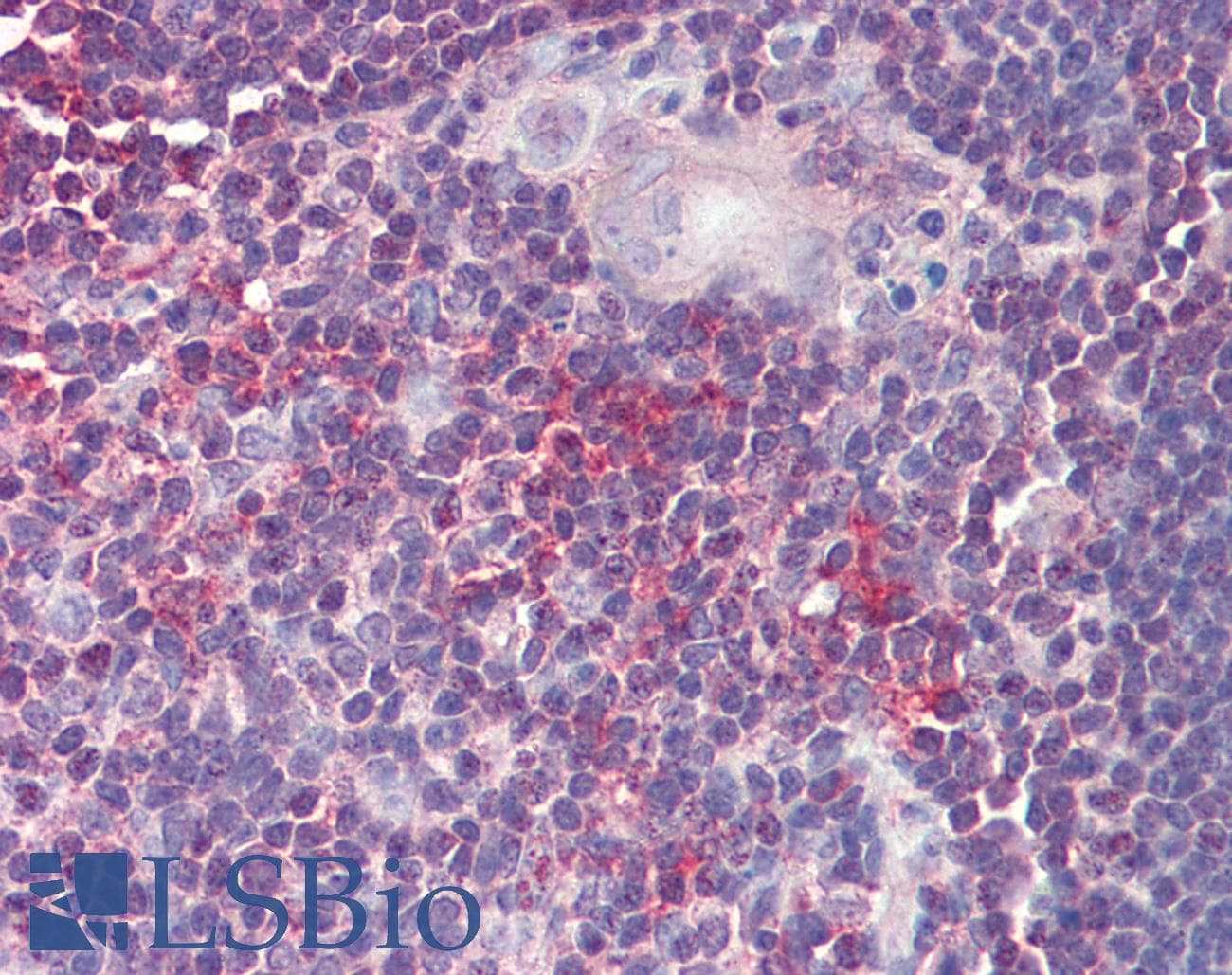 IHC-plus™ Polyclonal Goat anti-Human ARF4 Antibody (aa137-150, IHC, WB)