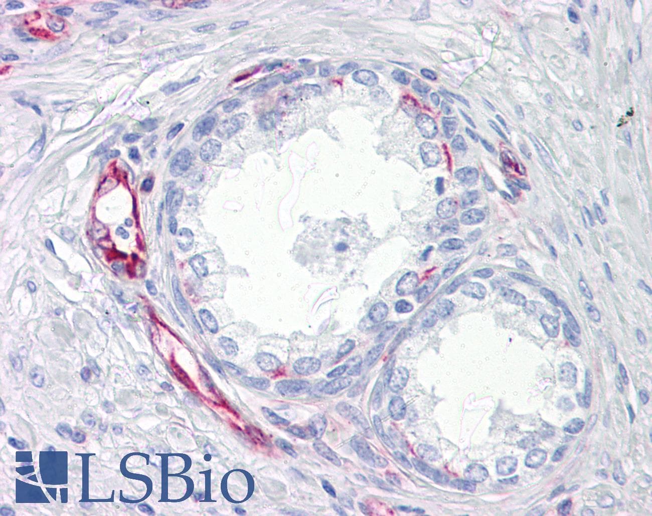 IHC-plus™ Monoclonal Mouse anti-Human Vimentin Antibody (clone RV203, IHC, WB)