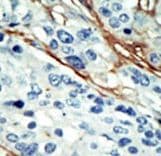 NUAK1 / ARK5 Antibody (aa604-634)