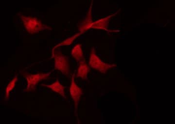 TP53 / p53 Antibody (phospho-Ser392)