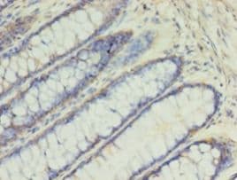 SLC2A4 / GLUT-4 Antibody (aa223-287, FITC)