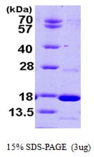 Human PDE6D / PDE6 Delta Protein (Recombinant His)