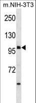 Harmonin / USH1C Antibody (aa1-30)