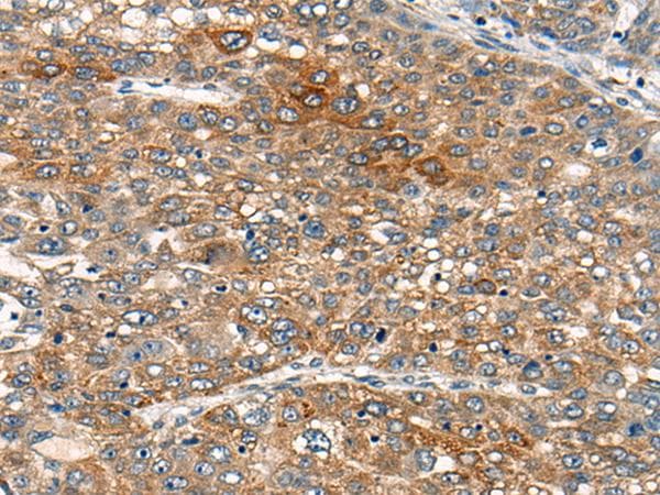 B4GAT1 / B3GNT1 Antibody