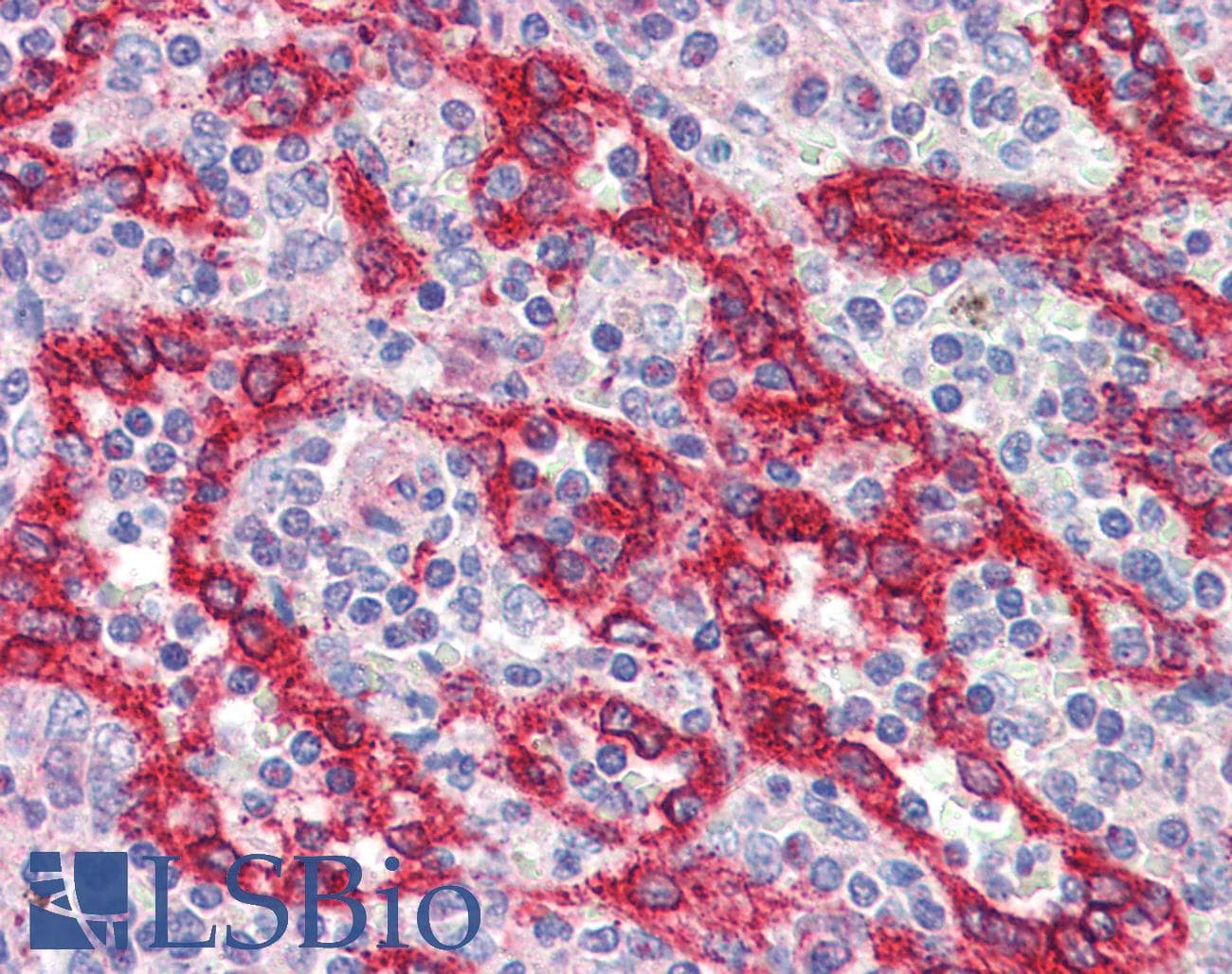 IHC-plus™ ATG16L1 / ATG16L Antibody (aa1-100)