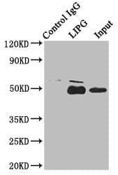 LIPG / Endothelial Lipase Antibody