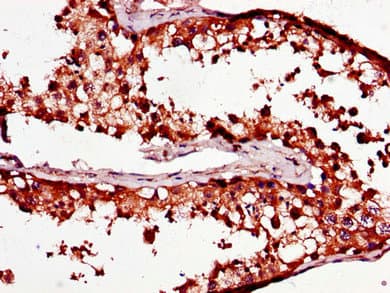 PCOTH Antibody