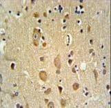 APITD1 Antibody (aa48-74)