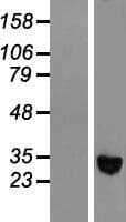 ADH1C Protein (Over-Expression Lysate Myc-DDK (Flag))