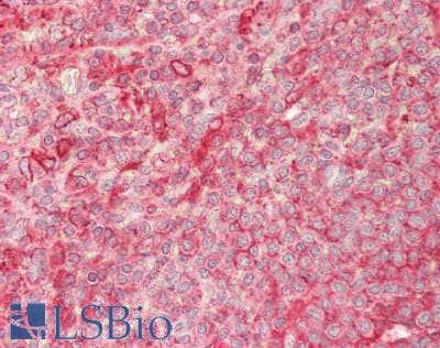 IHC-plus™ Polyclonal Rabbit anti-Human HMOX1 / HO-1 Antibody (aa3-288, IHC)