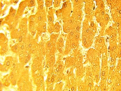 ADIRF Antibody (C-Terminus)