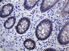 CDH1 / E Cadherin Antibody (clone OTI3E2)