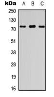 Polyclonal Rabbit anti-Human FIGNL1 Antibody (aa156-195, WB)