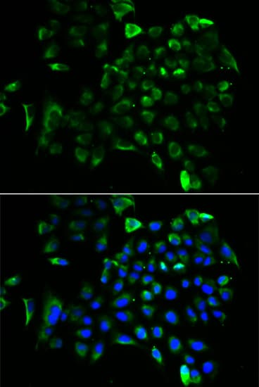 EF1B / EEF1B2 Antibody