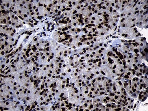 Monoclonal Mouse anti-Human HOXC4 Antibody (clone OTI2D5, IHC, WB)