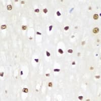 Polyclonal Rabbit anti-Human SQSTM1 Antibody (IHC, WB)