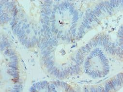 CBX8 Antibody (aa80-280)