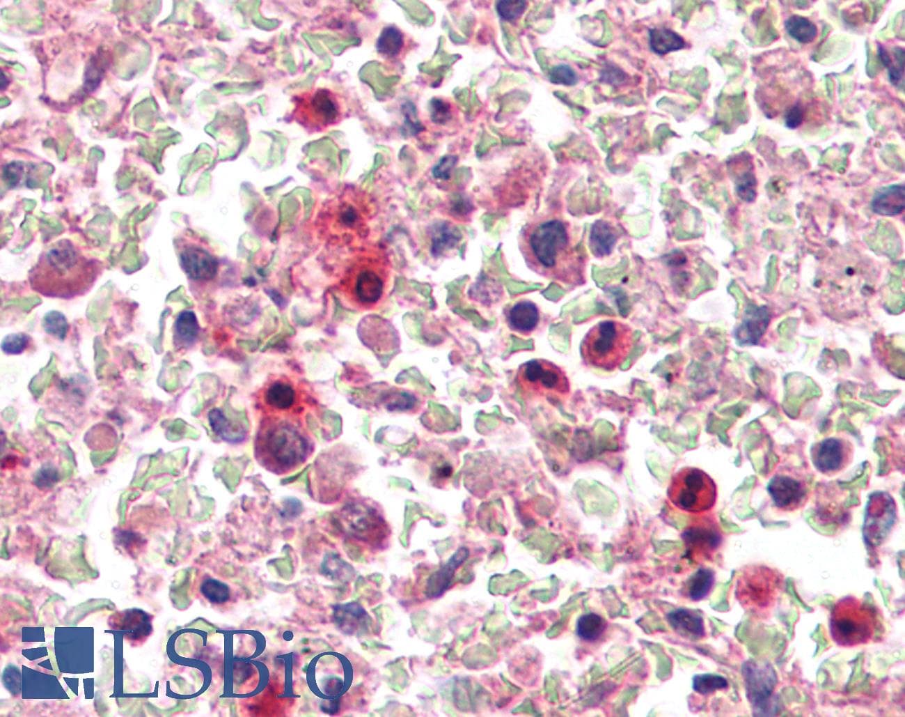 IHC-plus™ IRAK2 / IRAK-2 Antibody