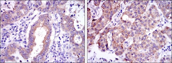 Monoclonal Mouse anti-Human REL / C-Rel Antibody (clone 10000000, IHC, IF, WB)