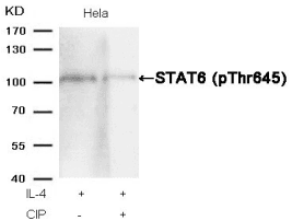 Polyclonal Rabbit anti-Human STAT6 Antibody (IHC, WB)