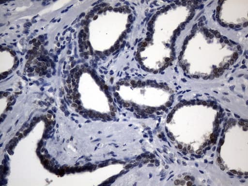 TS / Thymidylate Synthase Antibody (clone UMAB227)