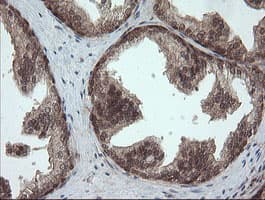 OTUB1 / OTU1 Antibody (clone OTI5F7)