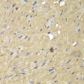 AKR7A2 / AFAR Antibody
