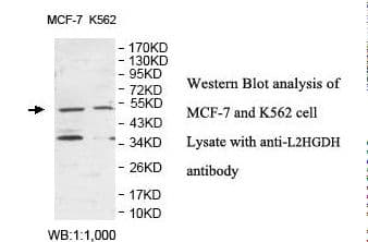 Polyclonal Rabbit anti-Human L2HGDH Antibody (aa65-216, IHC, WB)