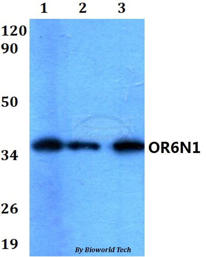 OR6N1 Antibody