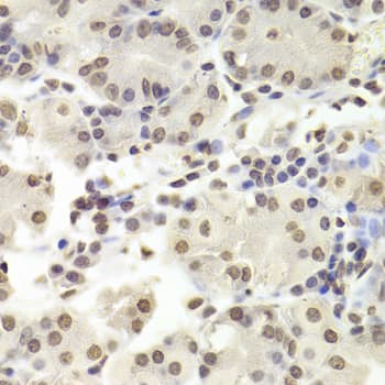 TIP49 / RUVBL1 Antibody