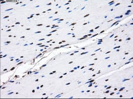 Monoclonal Mouse anti-Human GBE1 Antibody (clone OTI1D11, IHC, IF, WB)