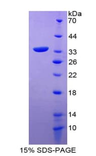 Human SLC9A3R2 / SIP1 Protein (Recombinant His-T7)