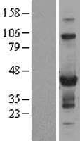 ZNF784 Protein (Over-Expression Lysate Myc-DDK (Flag))