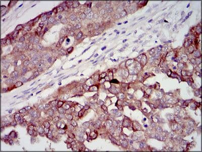 IGF2 Antibody (Amino Acid: 25-180, clone 8H1)