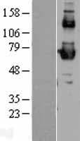 Human SCARB1 / SR-BI Protein (Over-Expression Lysate Myc-DDK (Flag))