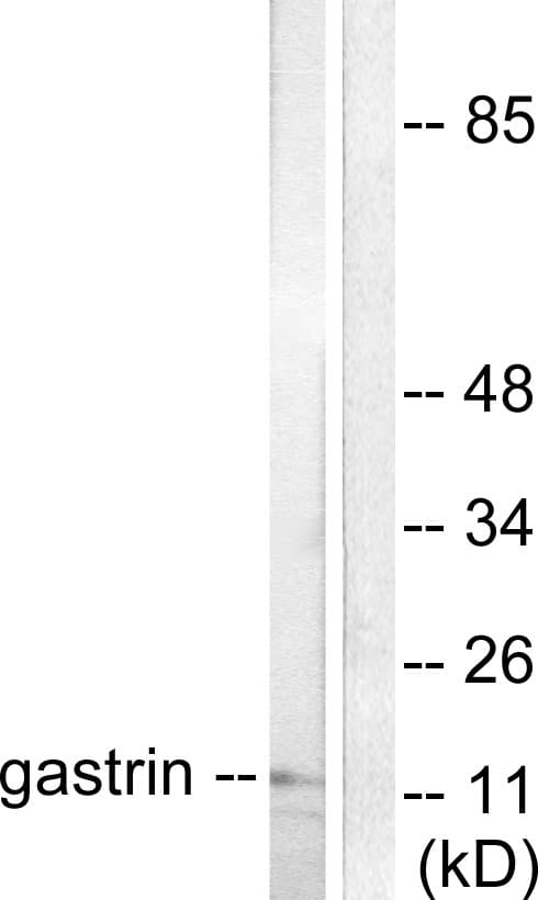 Gastrin Antibody (aa52-101)
