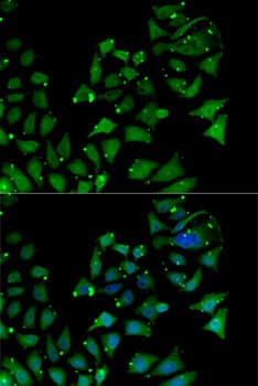 Polyclonal Rabbit anti-Human AIPL1 Antibody (IF, WB)