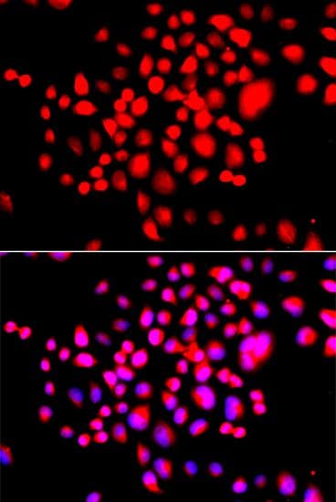STK19 Antibody