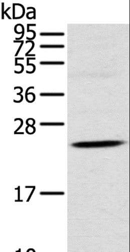TSPAN13 / TM4SF13 Antibody