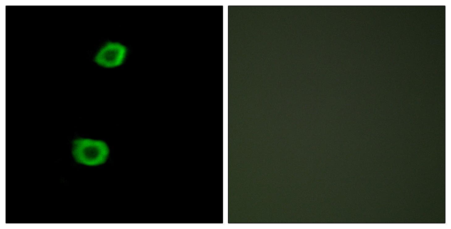 Polyclonal Rabbit anti-Human KPI-2 / LMTK2 Antibody (IHC, IF, WB)