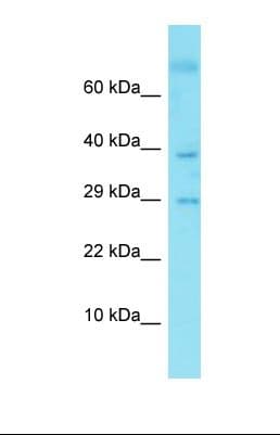 GLIPR2 Antibody (aa275-324)
