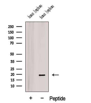 BTG1 Antibody