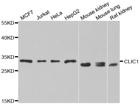Polyclonal Rabbit anti-Human CLIC1 / NCC27 Antibody (IHC, IF, WB)