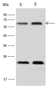 Polyclonal Rabbit anti-Human AHCYL1 / DCAL Antibody (IHC, IF, WB)