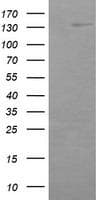 ERBB2 / HER2 Antibody (aa676-1255, clone OTI4G10, Carrier-free)