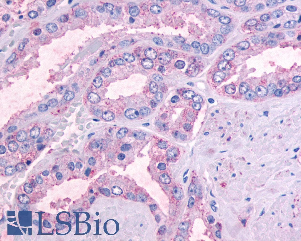 PathPlus™ Polyclonal Rabbit anti-Human OR51E1 Antibody (Cytoplasmic Domain, IHC)