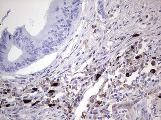 TLK2 Antibody (aa1-296, clone OTI2F9)