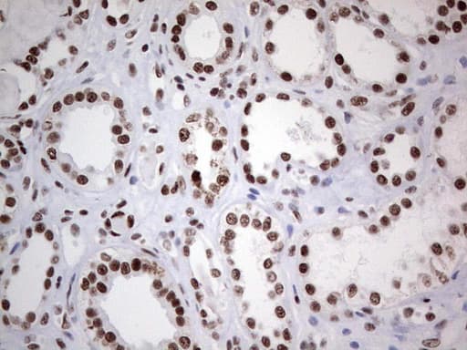 Monoclonal Mouse anti-Human HDAC9 Antibody (clone OTI7G2, aa181-460, IHC, WB)