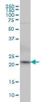 Monoclonal Mouse anti-Human NKIRAS2 Antibody (clone 2G9, IHC, WB)